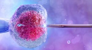 IVF procedure illustration showing embryo transfer at a fertility clinic